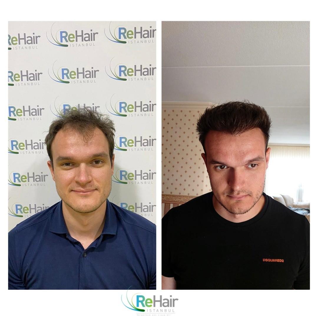before-after-4