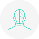 hair transplant