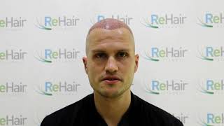 ReHair Istanbul Review - Haartransplantatie Turkije, Istanbul