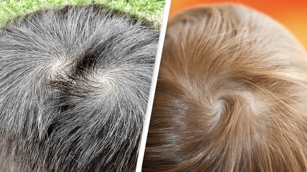whorl 1